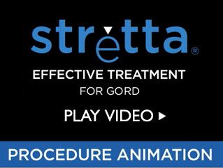 Stretta - Effective Treatment